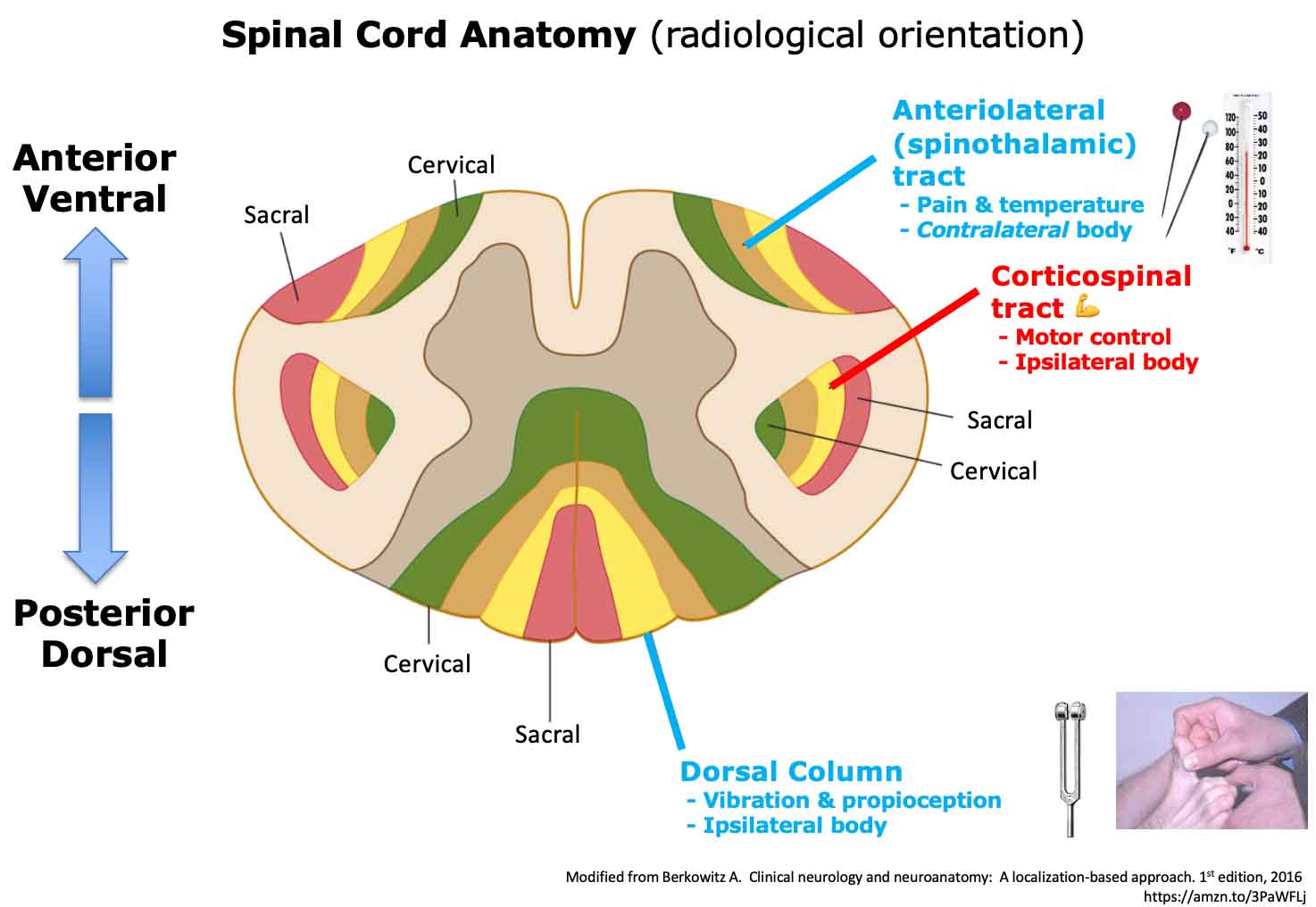 incomplete spinal cord syndromes